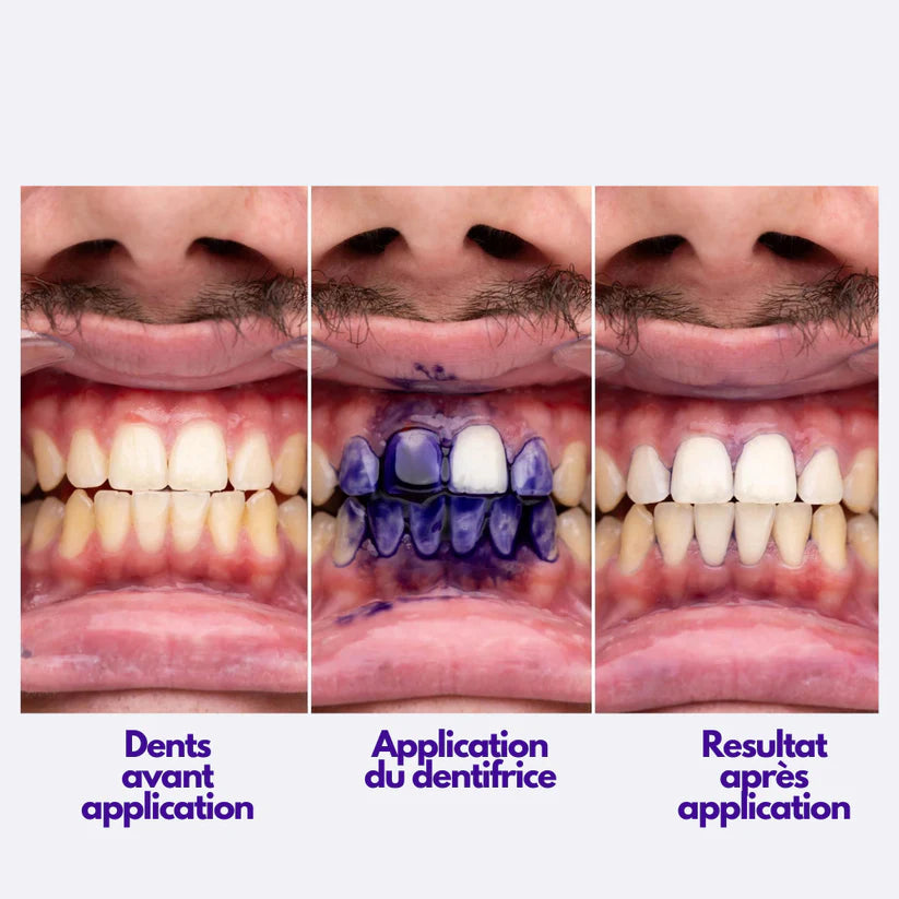 Dentilab V34 – Le Secret d’un Sourire Éclatant, Naturel et Instantané.