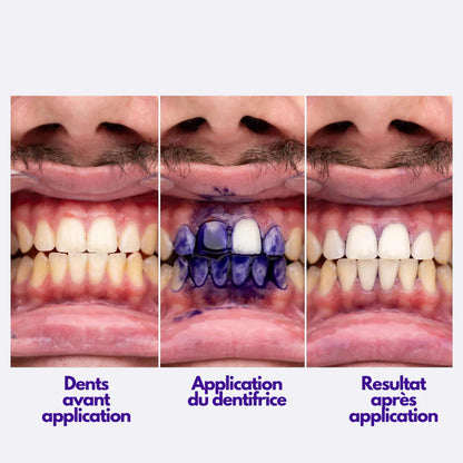 Dentilab V34 – Le Secret d’un Sourire Éclatant, Naturel et Instantané.